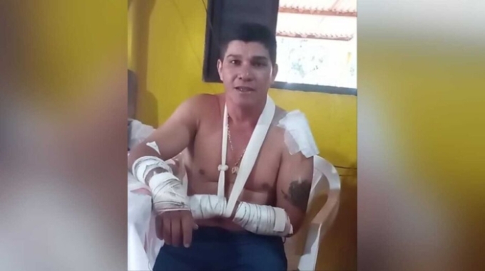 Motociclista que sobreviveu a ataque de onça em Rio Verde de Mato Grosso Motociclista que sobreviveu a ataque de onça em Rio Verde de Mato Grosso