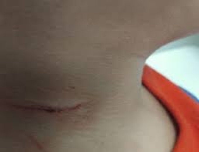 Criança de 8 anos usa caco de vidro para se cortar e parar briga dos pais