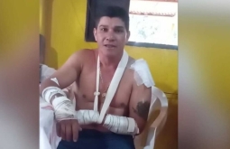 Motociclista que sobreviveu a ataque de onça em  Rio Verde de Mato Grosso